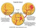 cellule tumorali